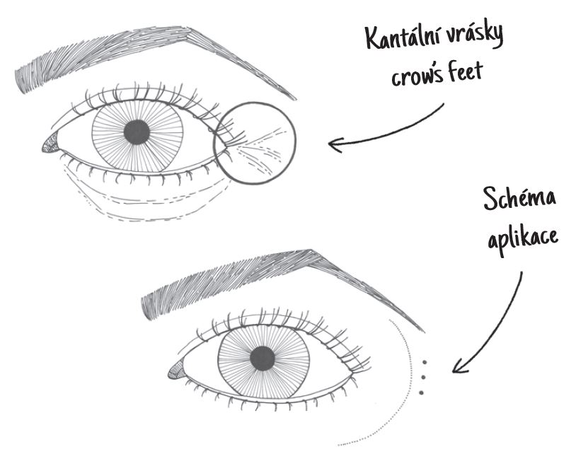 Kyselina hyaluronová